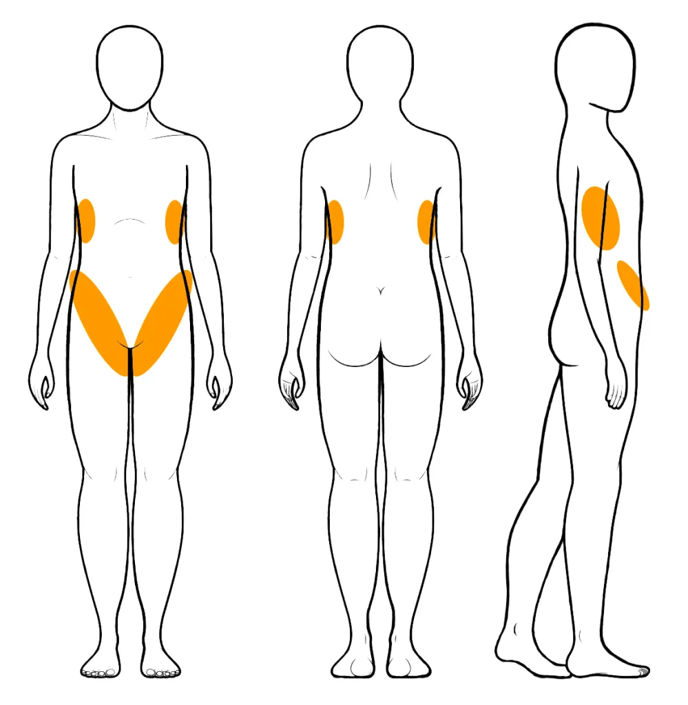 nervios-áreas-vulnerables-torso