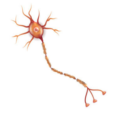 Neuropathie, d. h. die Schädigung von Nerven.